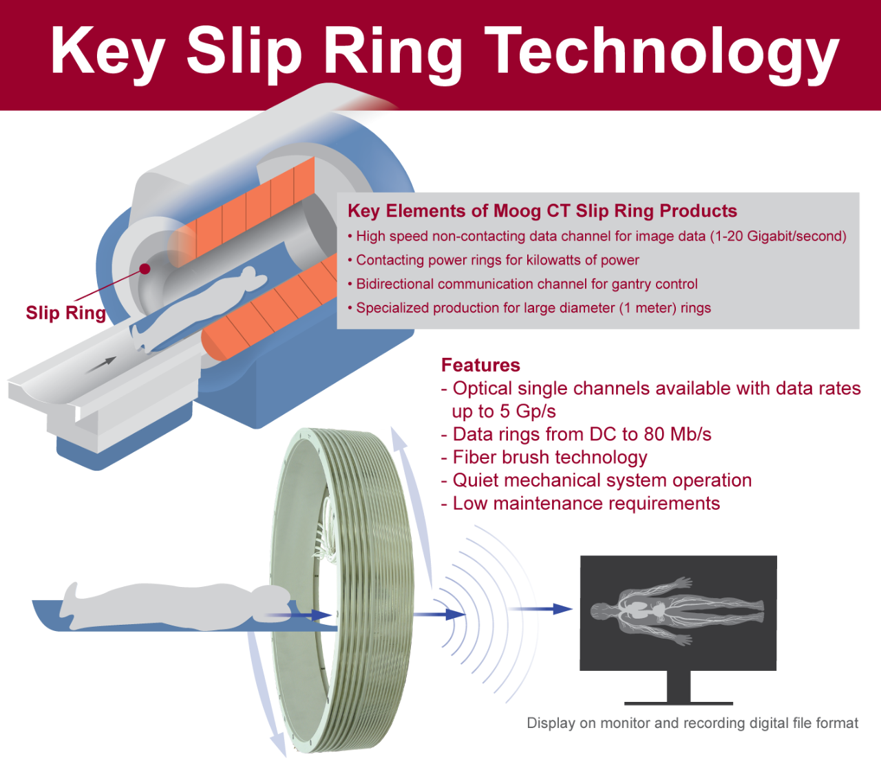 Proportioneel hoop leerplan Key Slip Ring Technology Behind Medical CT Systems